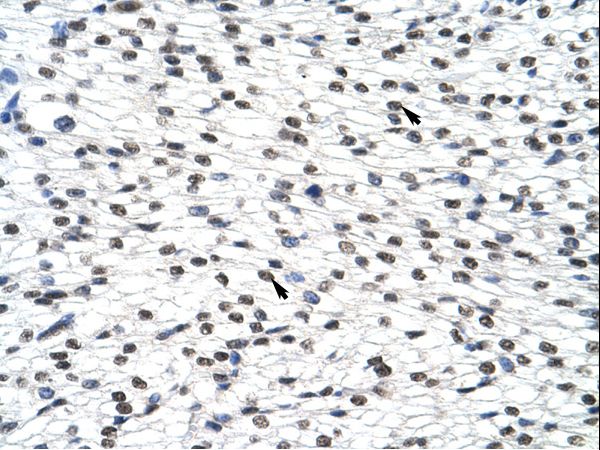 SURF6 antibody LS-C30869 was used in IHC to stain formalin-fixed, paraffin-embedded human heart.
