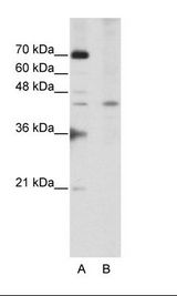 A: Marker, B: Jurkat Cell Lysate