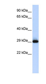 SUSD3 antibody LS-C102642 Western blot of Placenta lysate.
