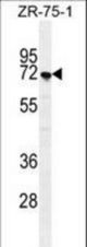 SUSD5 Antibody western blot of ZR-75-1 cell line lysates (35 ug/lane). The SUSD5 antibody detected the SUSD5 protein (arrow).