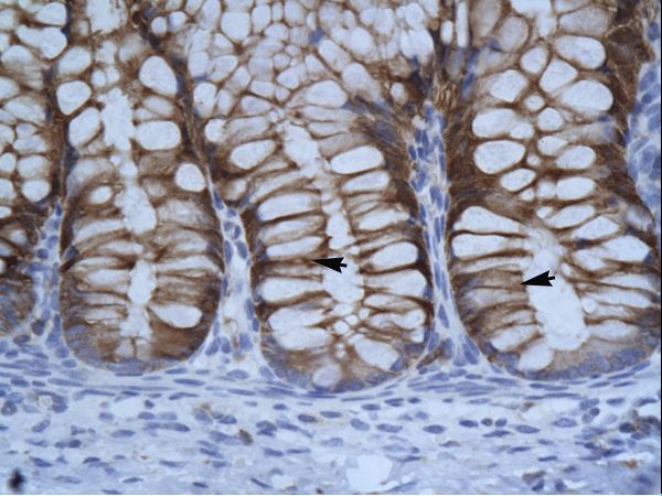 SUV39H1 antibody LS-C30987 was used in IHC to stain formalin-fixed, paraffin-embedded human intestine.