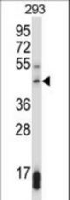 SUV39H1 Antibody western blot of 293 cell line lysates (35 ug/lane). The SUV39H1 antibody detected the SUV39H1 protein (arrow).