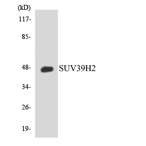 Western blot of the lysates from 293 cells using SUV39H2 antibody.