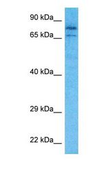Western blot of PRPF3 Antibody with human MCF7 Whole Cell lysate.