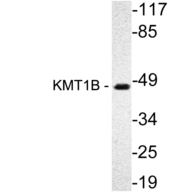 Western blot of KMT1B (H150) pAb in extracts from A549 cells.