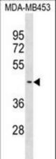 SUV39H2 Antibody western blot of MDA-MB453 cell line lysates (35 ug/lane). The SUV39H2 antibody detected the SUV39H2 protein (arrow).