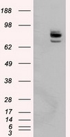 HEK293T cells were transfected with the pCMV6-ENTRY control (Left lane) or pCMV6-ENTRY PTPRE (Right lane) cDNA for 48 hrs and lysed. Equivalent amounts of cell lysates (5 ug per lane) were separated by SDS-PAGE and immunoblotted with anti-PTPRE.