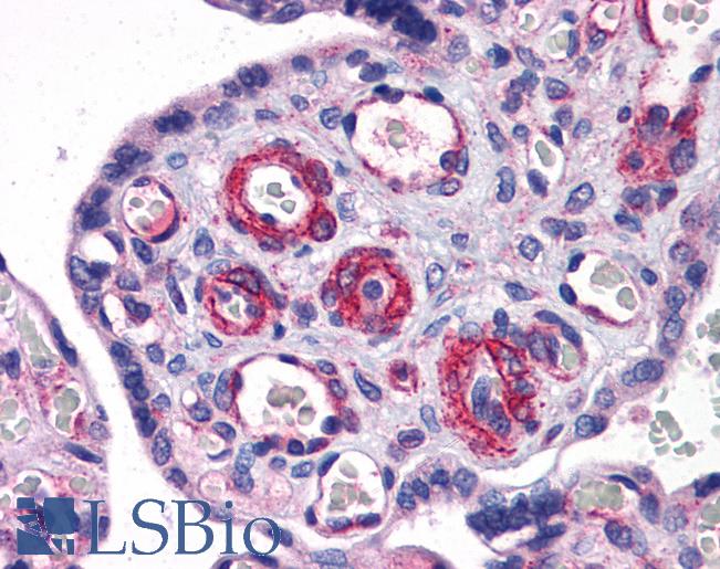 Anti-SUZ12 antibody IHC of human placenta. Immunohistochemistry of formalin-fixed, paraffin-embedded tissue after heat-induced antigen retrieval. Antibody LS-B5591 concentration 5 ug/ml.