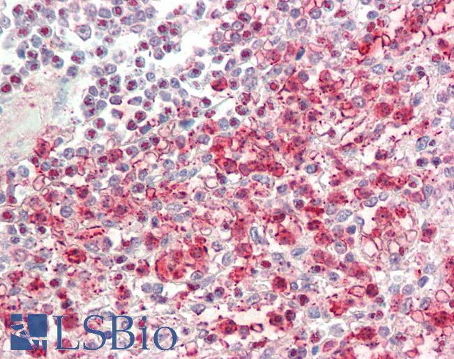 Anti-SUZ12 antibody IHC staining of human spleen. Immunohistochemistry of formalin-fixed, paraffin-embedded tissue after heat-induced antigen retrieval. Antibody LS-B10727 dilution 1:100.