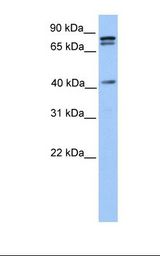 721_B cell lysate. Antibody concentration: 1.0 ug/ml. Gel concentration: 12%.