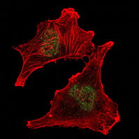 Immunofluorescence of U251 cells using SUZ12 mouse monoclonal antibody (green). Red: Actin filaments have been labeled with Alexa Fluor-555 phalloidin.