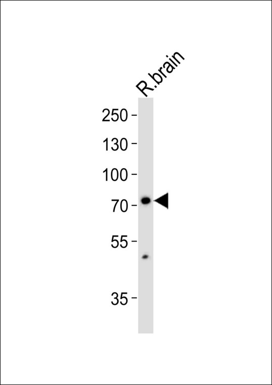 Western blot of lysate from rat brain tissue lysate with SV2C Antibody. Antibody was diluted at 1:1000. A goat anti-rabbit IgG H&L (HRP) at 1:10000 dilution was used as the secondary antibody. Lysate at 35 ug.