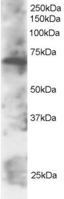 Antibody staining (2 ug/ml) of Daudi lysate (RIPA buffer, 30 ug total protein per lane). Primary incubated for 12 hour. Detected by Western blot of chemiluminescence.