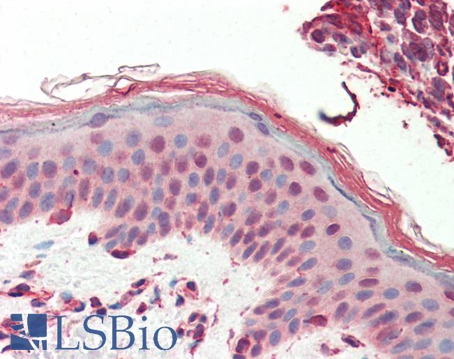 Anti-SWR1 / SRCAP antibody IHC staining of human skin. Immunohistochemistry of formalin-fixed, paraffin-embedded tissue after heat-induced antigen retrieval. Antibody LS-B10337 concentration 5 ug/ml.