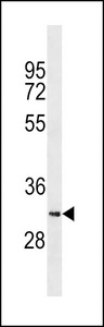 SYCE1L Antibody western blot of K562 cell line lysates (35 ug/lane). The SYCE1L antibody detected the SYCE1L protein (arrow).
