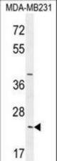 SYCE2 Antibody western blot of MDA-MB231 cell line lysates (35 ug/lane). The SYCE2 antibody detected the SYCE2 protein (arrow).