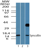 Western blot of syncollin in human pancreas lysate in the 1) absence and 2) presence of immunizing peptide and 3) rat pancreas using LS-C148459 at 0.05 ug/ml and 2 ug/ml, respectively.