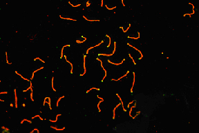 SCP3 labeled in mouse pachytene preparation (red), using LS-C2885. CDK2 staining, near teleomeres, is also present (green).