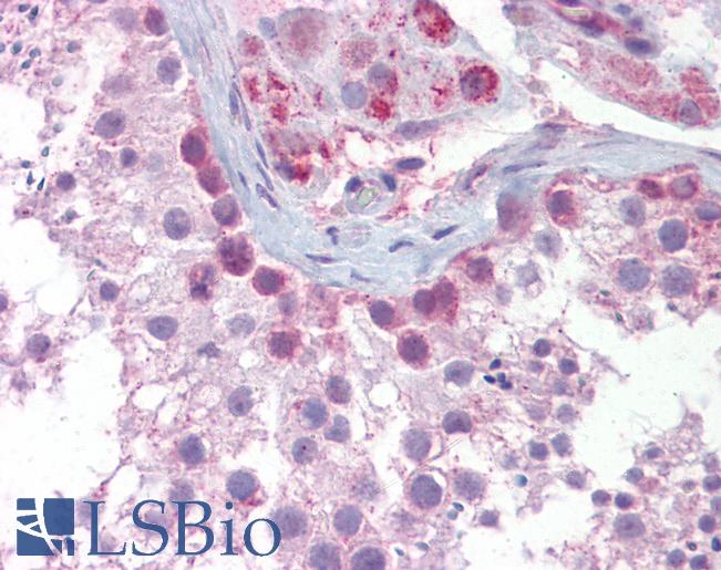 Anti-SYCP3 antibody IHC of human testis. Immunohistochemistry of formalin-fixed, paraffin-embedded tissue after heat-induced antigen retrieval. Antibody LS-B6637 concentration 5 ug/ml.