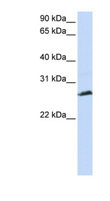SYCP3 antibody LS-B6637 Western blot of Jurkat lysate.
