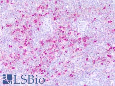 Anti-PTPRE antibody IHC of human spleen. Immunohistochemistry of formalin-fixed, paraffin-embedded tissue after heat-induced antigen retrieval. Antibody LS-A6801 dilution 3-32 ug/ml.