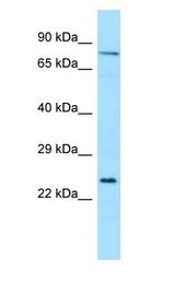 SYK antibody Western Blot of THP-1.