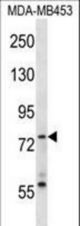 Mouse Syk Antibody western blot of MDA-MB453 cell line lysates (35 ug/lane). The Syk antibody detected the Syk protein (arrow).