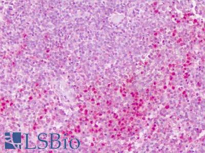 Anti-PTPRE antibody IHC of human spleen. Immunohistochemistry of formalin-fixed, paraffin-embedded tissue after heat-induced antigen retrieval. Antibody LS-A6799 dilution 3-6 ug/ml.