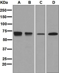 Western blot analysis on (A) HL-60 treated with TPA, (B) HL-60, (C) HeLa, and (D) C2C12 cell lysates using anti-PTPRE antibody.