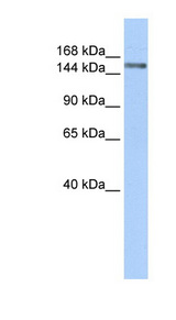 SYMPK / Symplekin antibody LS-C101988 Western blot of Fetal Liver lysate.
