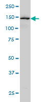 LS-B6171 Western blot of SYMPK expression in COLO 320 HSR.