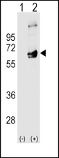 Western blot of FYN (arrow) using rabbit polyclonal FYN Antibody. 293 cell lysates (2 ug/lane) either nontransfected (Lane 1) or transiently transfected (Lane 2) with the FYN gene.