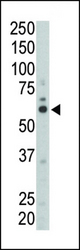 Western blot of anti-FYN antibody in mouse liver tissue lysate. FYN (arrow) was detected using purified antibody. Secondary HRP-anti-rabbit was used for signal visualization with chemiluminescence.