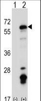 Western blot of Fyn (arrow) using rabbit polyclonal Mouse Fyn Antibody. 293 cell lysates (2 ug/lane) either nontransfected (Lane 1) or transiently transfected (Lane 2) with the Fyn gene.
