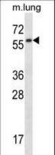 Mouse Fyn Antibody western blot of mouse lung tissue lysates (35 ug/lane). The Fyn antibody detected the Fyn protein (arrow).
