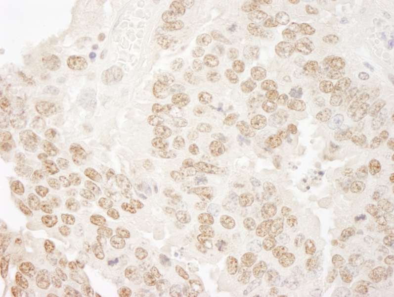 Detection of Mouse hPrp3p Immunohistochemistry. Sample: FFPE section of mouse teratoma. Antibody: Affinity purified rabbit anti-hPrp3p used at a dilution of 1:100.