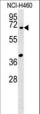 SYN3 Antibody western blot of NCI-H460 cell line lysates (15 ug/lane). The SYN3 antibody detected the SYN3 protein (arrow).