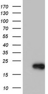 HEK293T cells were transfected with the pCMV6-ENTRY control (Left lane) or pCMV6-ENTRY SYNC (Right lane) cDNA for 48 hrs and lysed. Equivalent amounts of cell lysates (5 ug per lane) were separated by SDS-PAGE and immunoblotted with anti-SYNC.