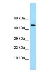 SYNC / SYNCOILIN antibody Western Blot of Fetal Heart. Antibody dilution: 1 ug/ml.