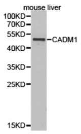 Western blot of extracts of mouse liver cell lines, using CADM1 antibody.