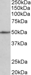 CADM1 antibody (1 ug/ml) staining of Mouse fetal Heart lysate (35 ug protein in RIPA buffer). Primary incubation was 1 hour. Detected by chemiluminescence.