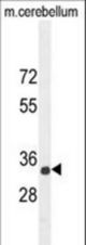 CADM1 Antibody western blot of mouse cerebellum tissue lysates (35 ug/lane). The CADM1 antibody detected the CADM1 protein (arrow).
