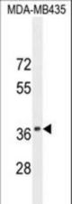CADM1 Antibody western blot of MDA-MB435 cell line lysates (35 ug/lane). The CADM1 antibody detected the CADM1 protein (arrow).
