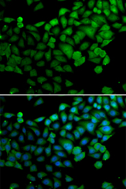 Immunofluorescence blot of MCF7 cell using SYNCRIP antibody. Blue: DAPI for nuclear staining.