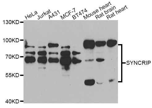 Western blot blot of extracts of various cell lines, using SYNCRIP antibody.