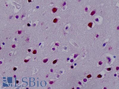 Human, Brain, neurons: Formalin-Fixed Paraffin-Embedded (FFPE)