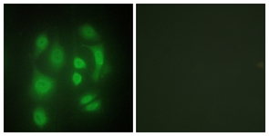 Immunofluorescence of HepG2 cells, using hnRNP Q Antibody. The picture on the right is treated with the synthesized peptide.