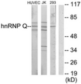 Western blot of extracts from Jurkat/HUVEC/293 cells, using hnRNP Q Antibody. The lane on the right is treated with the synthesized peptide.
