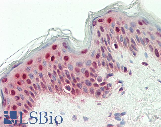 Anti-SYNCRIP / HnRNP Q antibody IHC staining of human skin. Immunohistochemistry of formalin-fixed, paraffin-embedded tissue after heat-induced antigen retrieval. Antibody LS-B11374 concentration 20 ug/ml.