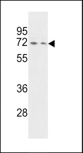 Western blot of HNRPQ Antibody in HeLa and Jurkat cell line lysates (35 ug/lane). HNRPQ (arrow) was detected using the purified antibody.